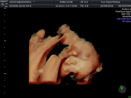 Fun Fetal Photos 3D Ultrasound prenatal imaging