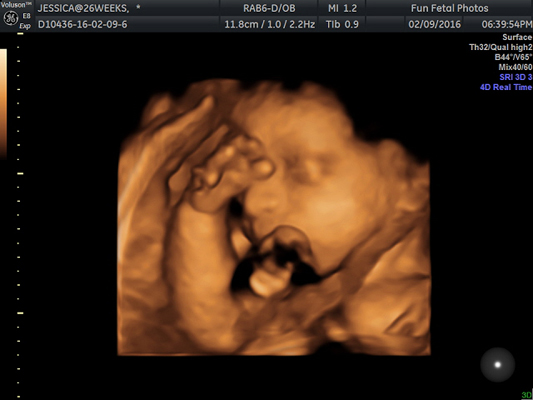 Fun Fetal Photos 3D Ultrasound prenatal imaging