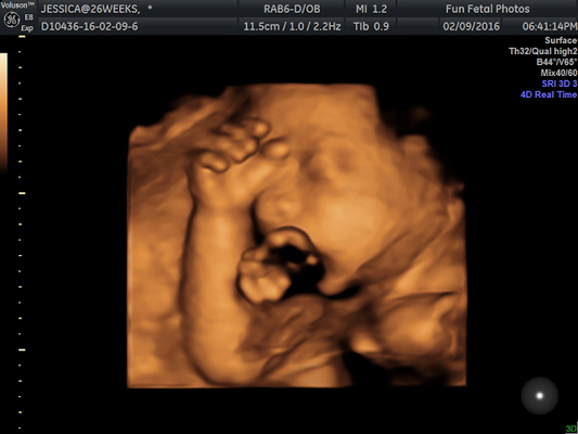 Fun Fetal Photos 3D Ultrasound prenatal imaging