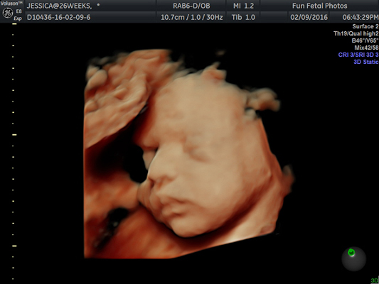 Fun Fetal Photos 3D Ultrasound prenatal imaging