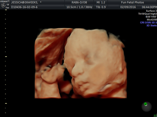 Fun Fetal Photos 3D Ultrasound prenatal imaging