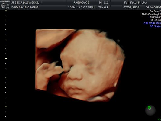 Fun Fetal Photos 3D Ultrasound prenatal imaging