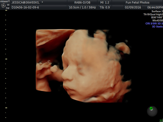 Fun Fetal Photos 3D Ultrasound prenatal imaging