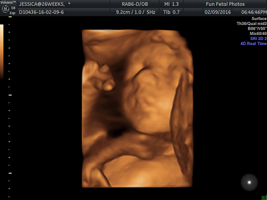 Fun Fetal Photos 3D Ultrasound prenatal imaging