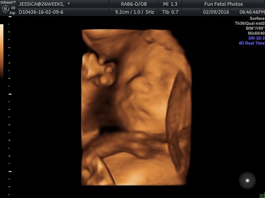 Fun Fetal Photos 3D Ultrasound prenatal imaging