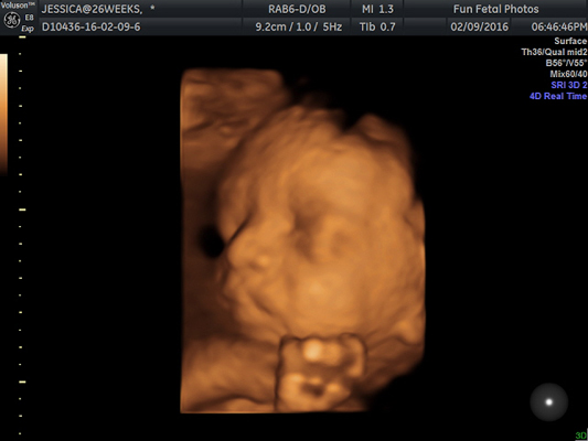 Fun Fetal Photos 3D Ultrasound prenatal imaging