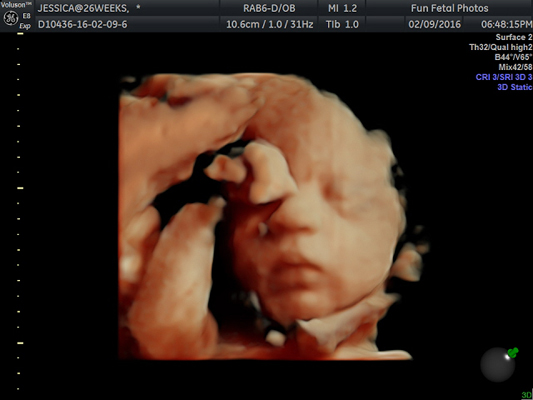 Fun Fetal Photos 3D Ultrasound prenatal imaging