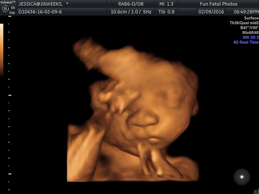 Fun Fetal Photos 3D Ultrasound prenatal imaging