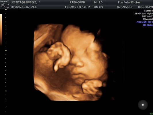 Fun Fetal Photos 3D Ultrasound prenatal imaging
