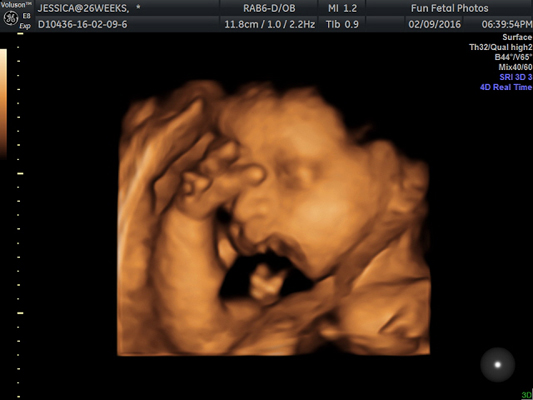 Fun Fetal Photos 3D Ultrasound prenatal imaging