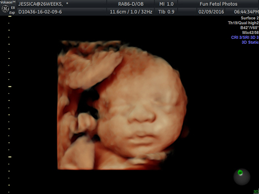 Fun Fetal Photos 3D Ultrasound prenatal imaging