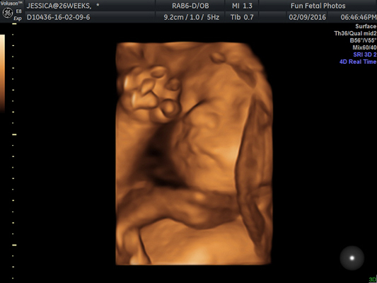 Fun Fetal Photos 3D Ultrasound prenatal imaging