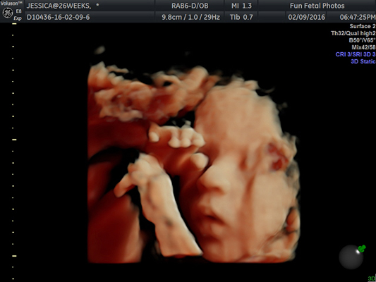 Fun Fetal Photos 3D Ultrasound prenatal imaging