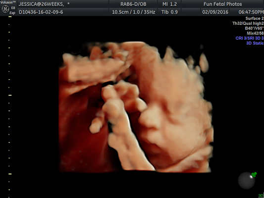 Fun Fetal Photos 3D Ultrasound prenatal imaging