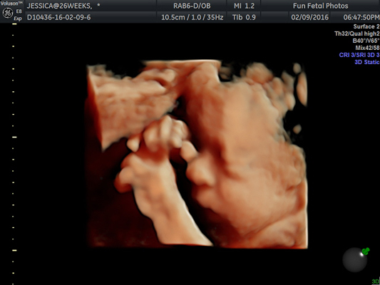 Fun Fetal Photos 3D Ultrasound prenatal imaging