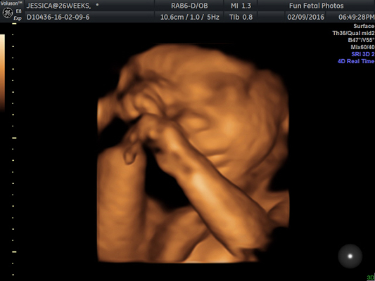 Fun Fetal Photos 3D Ultrasound prenatal imaging